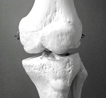 Arthritis Symptoms & Early Signs to Watch For