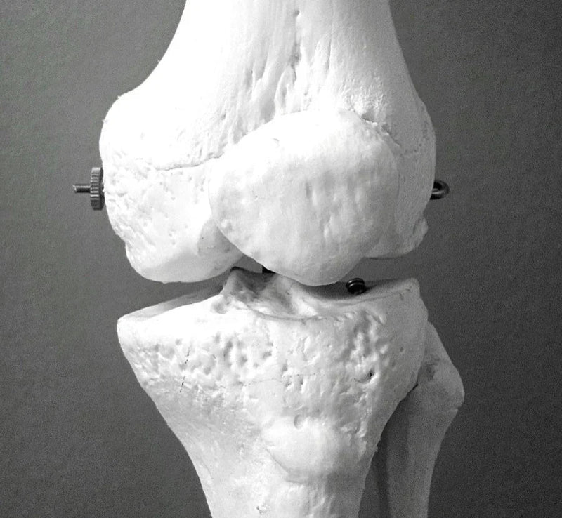 Arthritis Symptoms & Early Signs to Watch For