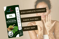 BK - A Complete End Of Vitiligo - (برس کا مکمل خاتمہ)