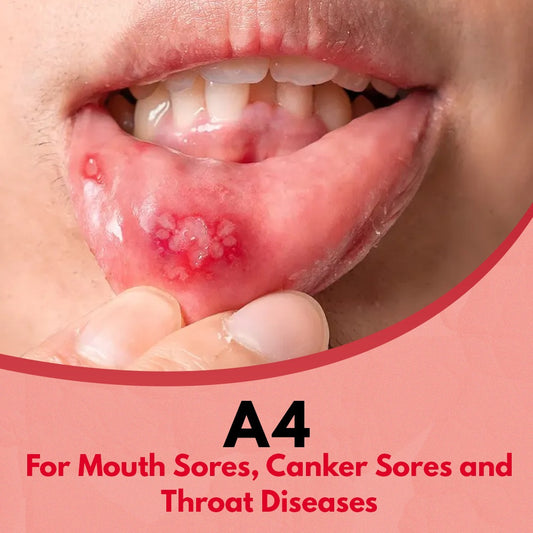 A4 - For mouth sores, canker sores and throat diseases (منہ کے چھالے زخم ناسور حلق کے امراض کیلئے)