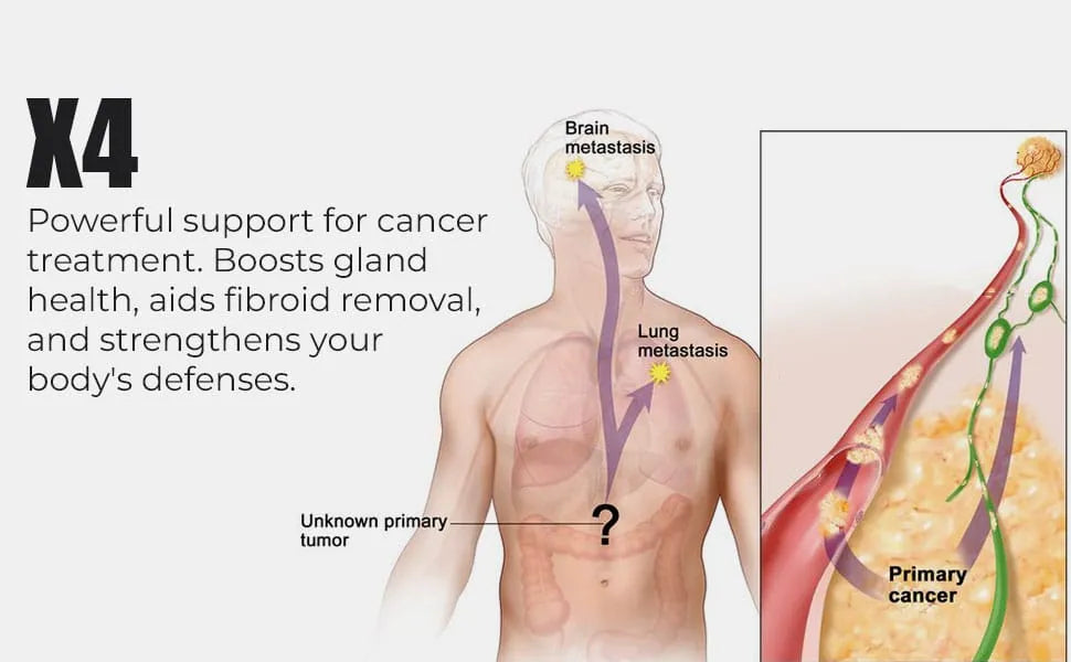 X4 for Primary Cancer Treatment